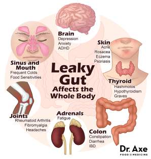 leaky gut symptoms